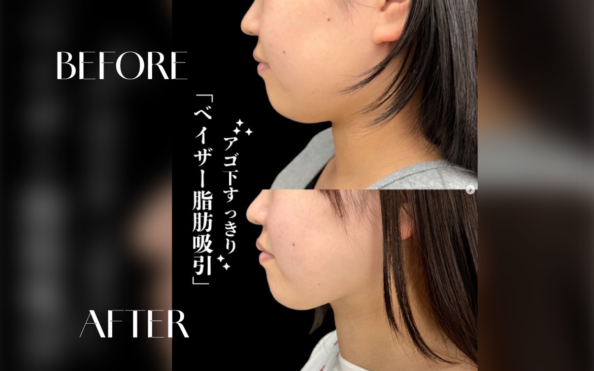 【小顔】180度どこから見ても美しいフェイスライン