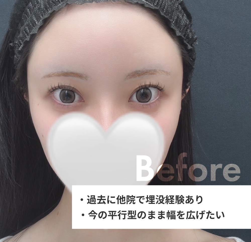 受けた施術は【クイックコスメティーク・トリプルNEO】