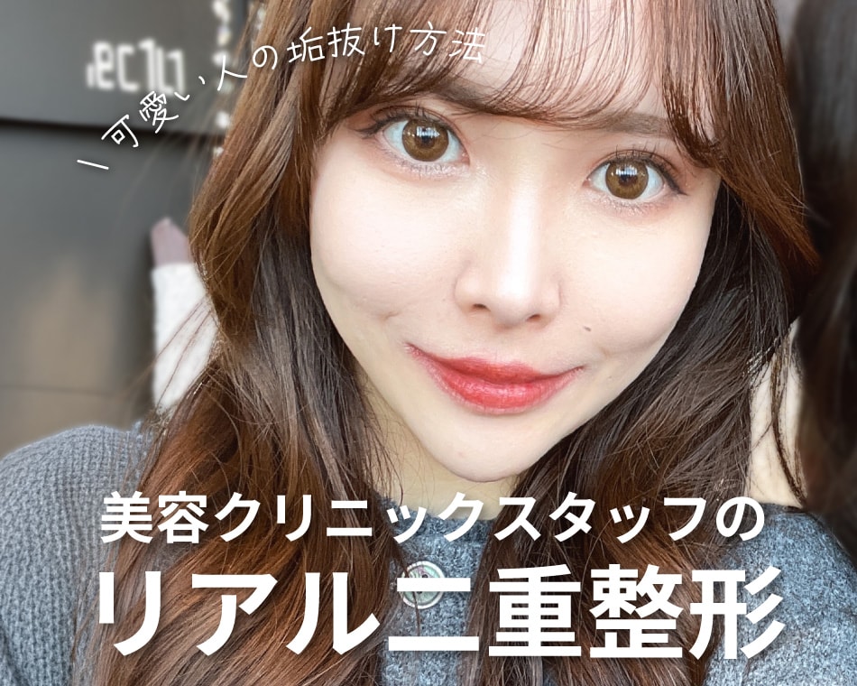 【大阪で二重おすすめ医師】「みんなが受けているからお願いしました！」スタッフが選ぶ本当の埋没二重の名医