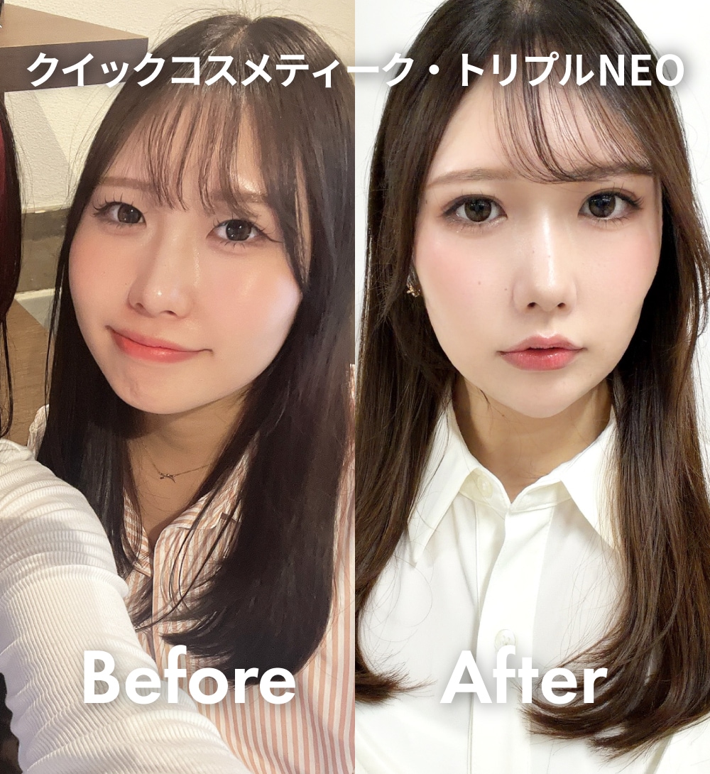 幅広二重でも、本当に自然で嬉しい！