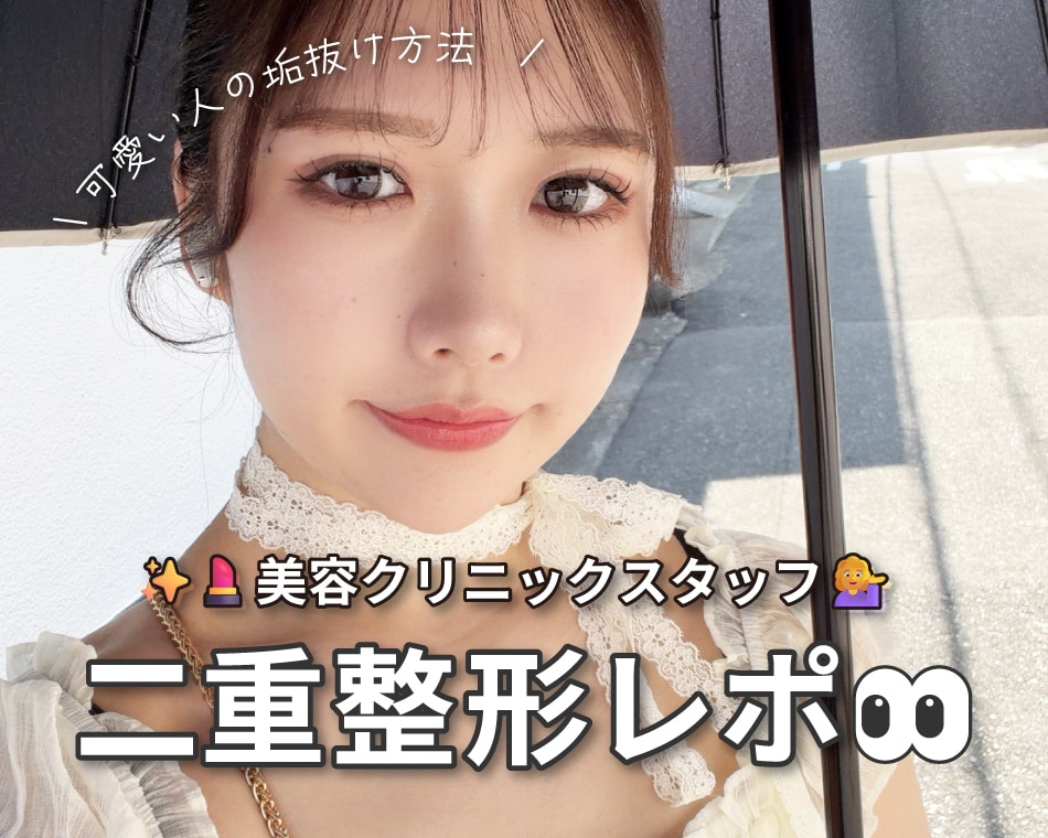 【大阪で二重おすすめ医師】「周りで受けてる子が本当に多いんです!」スタッフが選ぶ本当の埋没二重の名医