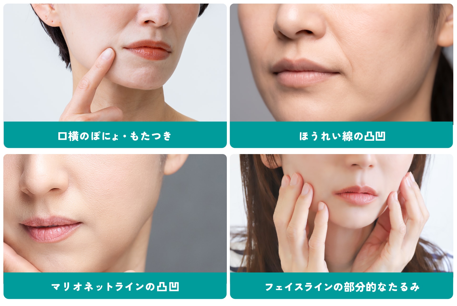 たるみで起こる様々な［ 凹凸 ］をぴたっと