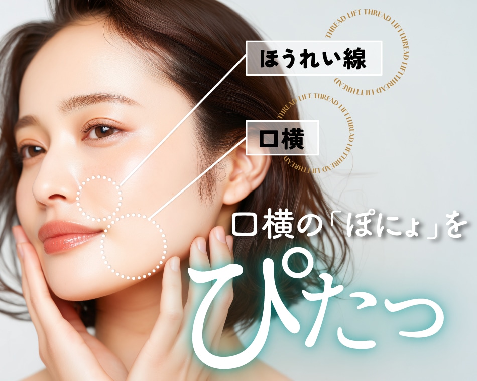 大阪のたるみ治療|【新治療】口元のぽにょっと感を改善「ぽにょぴたスレッド」って?