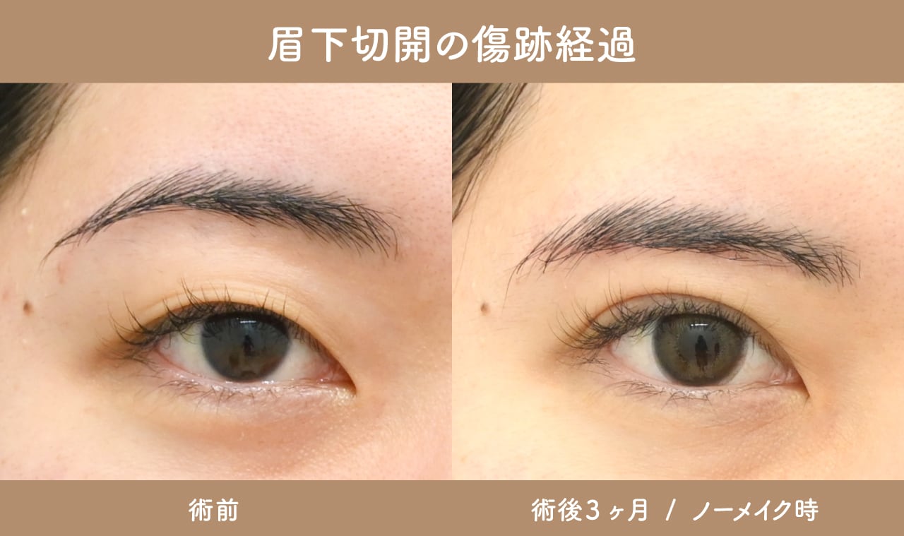 術後の自然さを叶えるデザイン力
