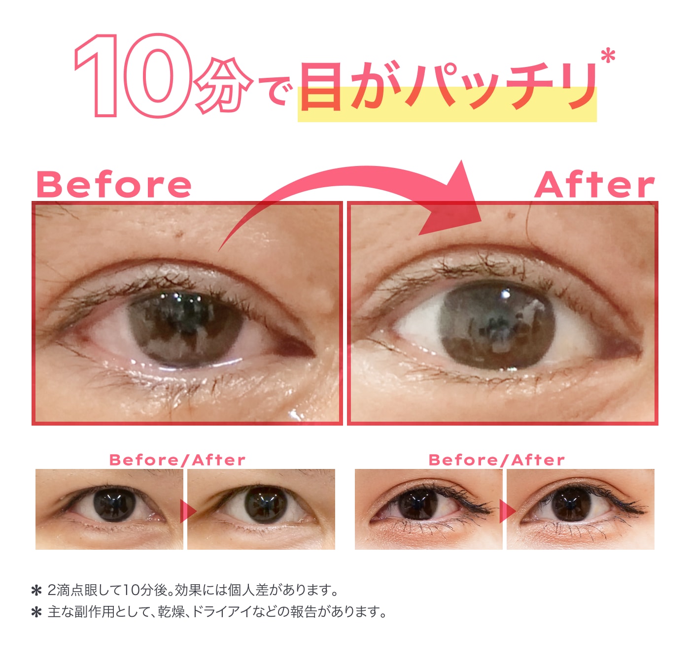 点眼して待つだけ❗️