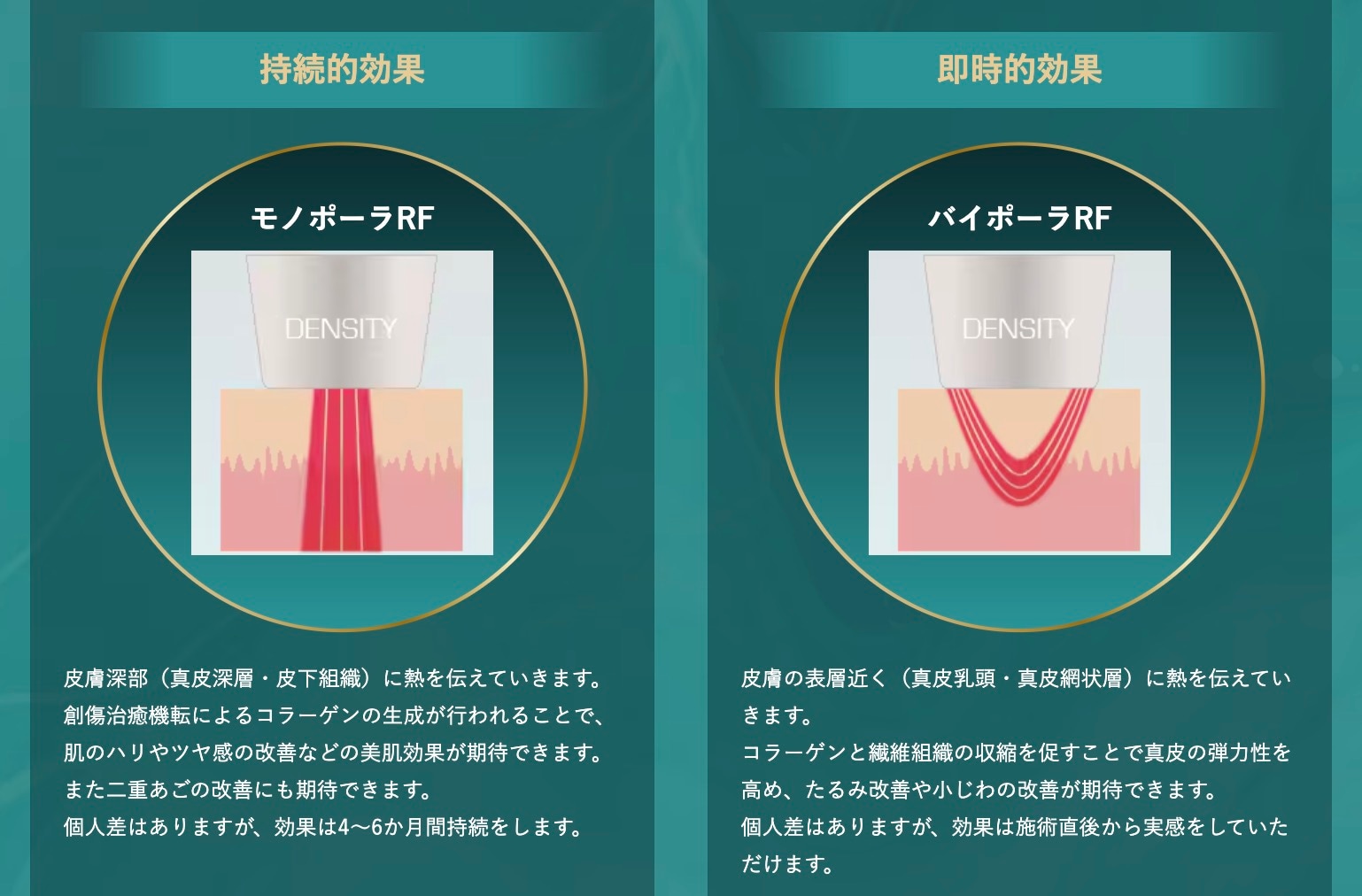 デンシティのここがすごい!