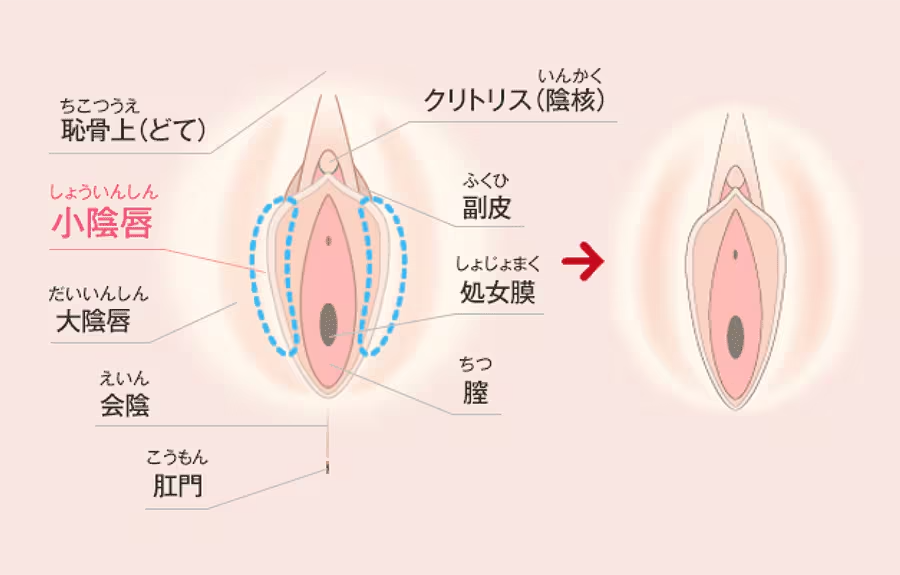 女性の3人に1人は悩んでいます