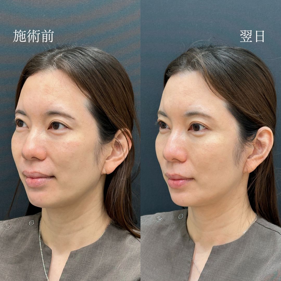 1日で効果実感♪