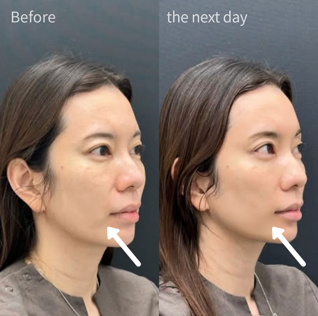 [Changes from immediately after the procedure to the next day]