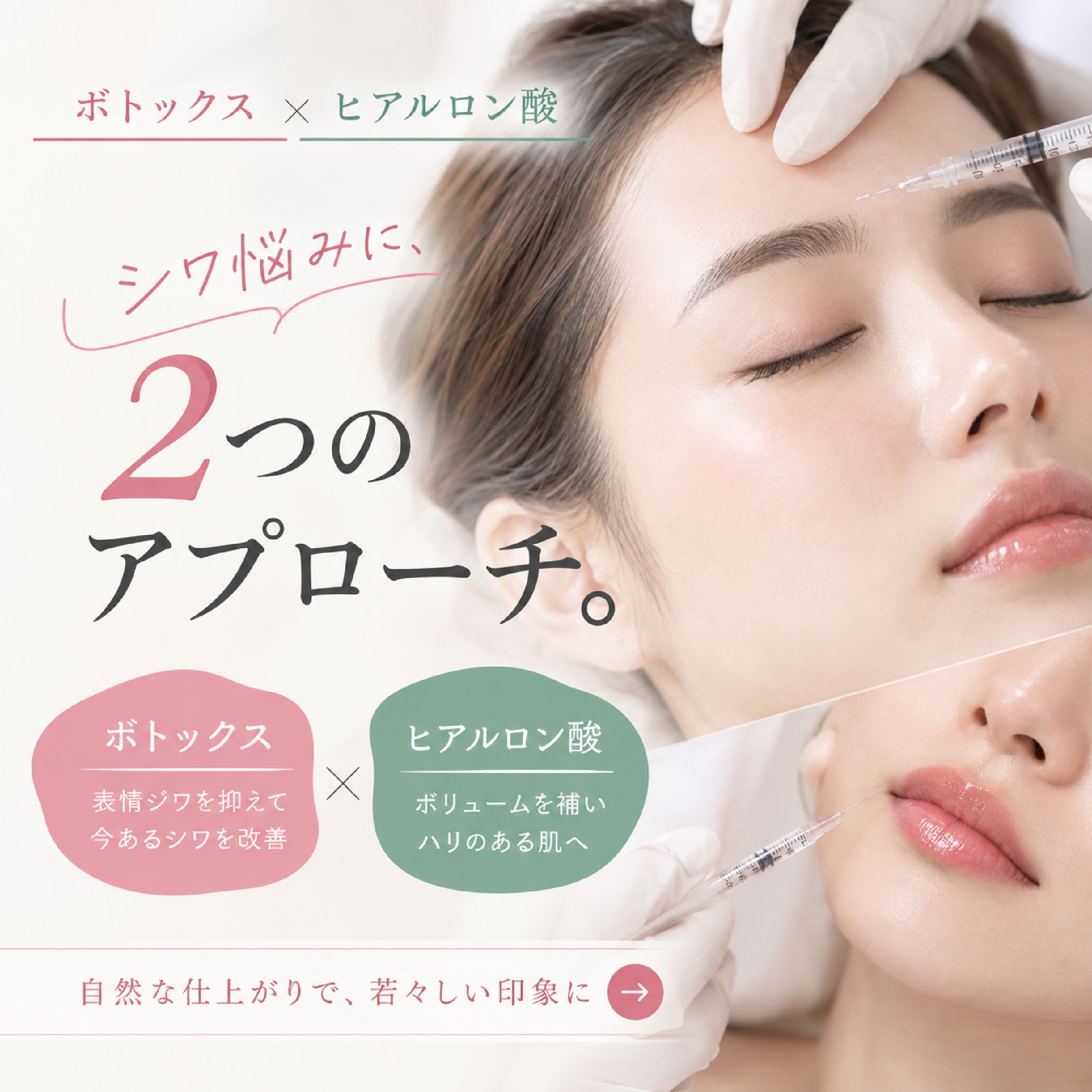 【シワ消し最強タッグ🤝🏻】表情ジワも､ほうれい線も｡《ボトックス×ヒアルロン酸》の合わせ技で悩み知らずの肌へ👶🏻