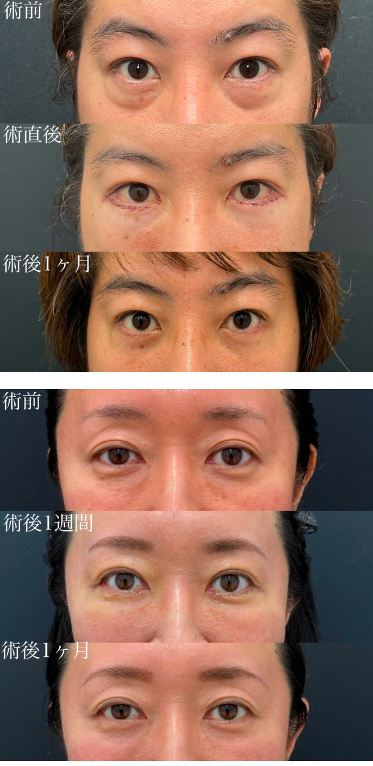 症例紹介