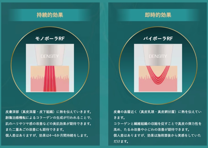 ポイント1　モノポーラ+バイポーラのモノバイ技術