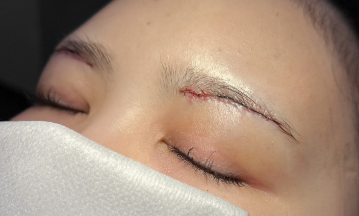 1.傷跡がきれい