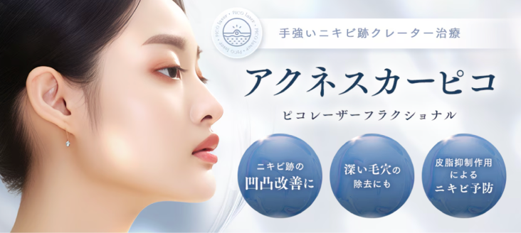 アクネスカーピコとは
