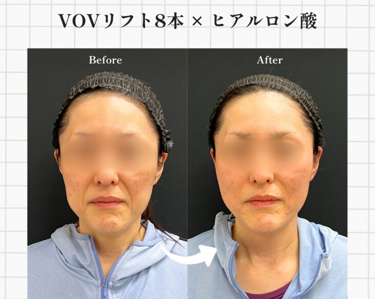 ふと鏡を見て「老けたかも」と感じたことはありませんか？