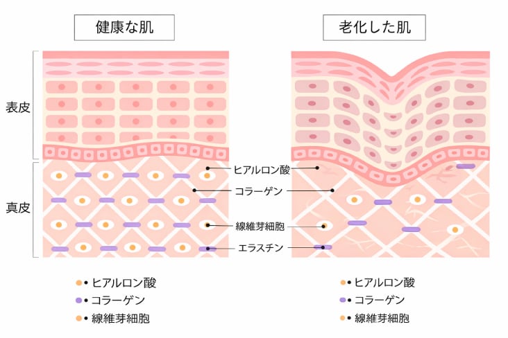 ハリの低下・小ジワ・毛穴の開きが気になり始めたら