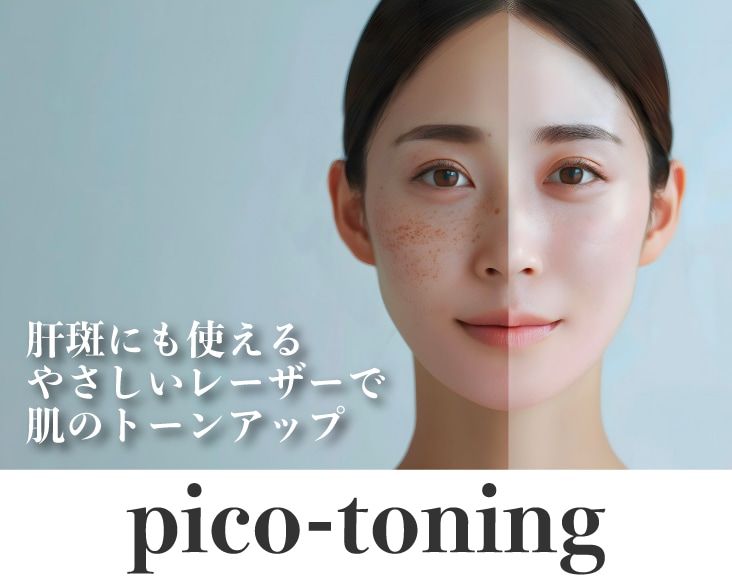 新横浜でピコトーニング｜肝斑にも使えるやさしいレーザーで肌のトーンアップ