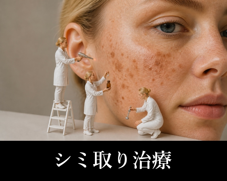 新横浜でシミ取り治療｜あなたのシミに合うレーザーを女性医師が提案