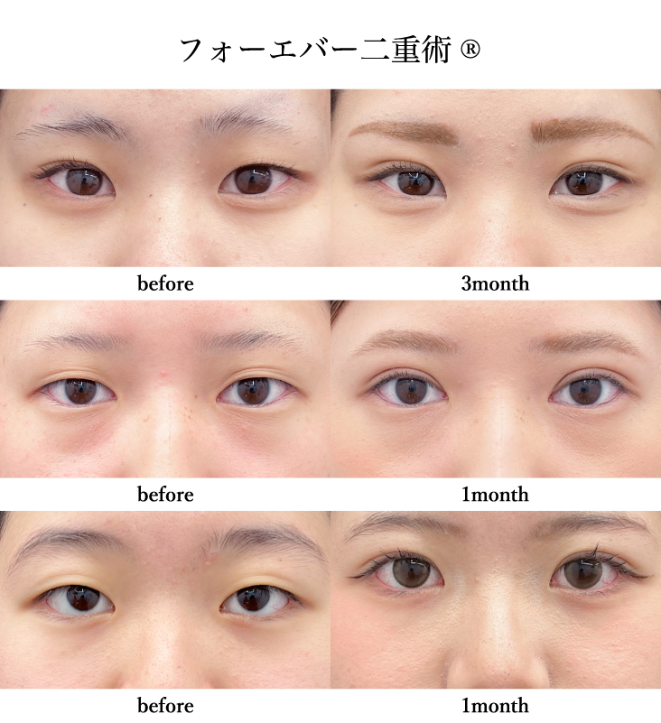 症例写真