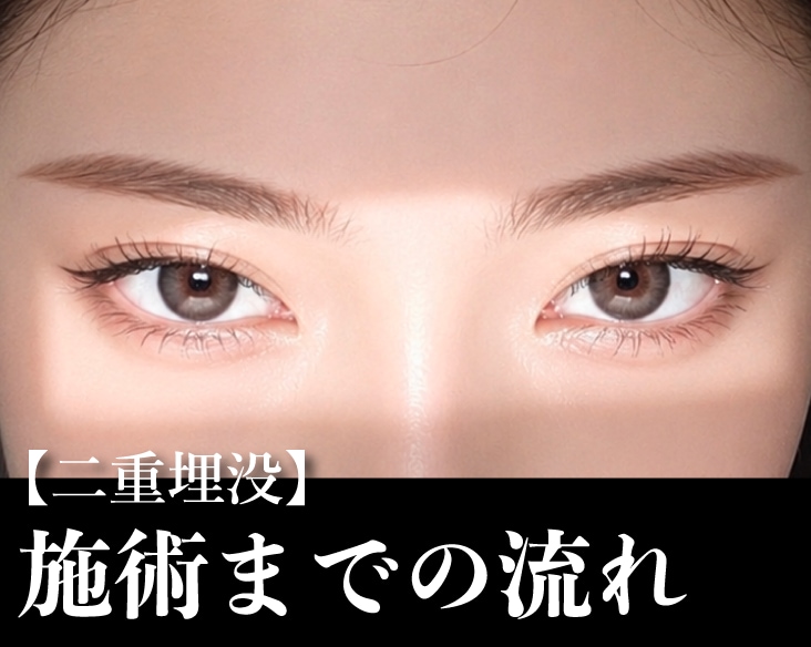 【新横浜院】二重埋没って当日できるの!?