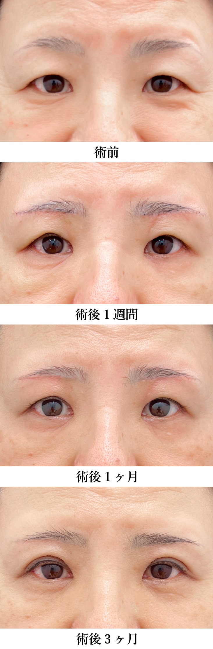 清水医師 症例写真