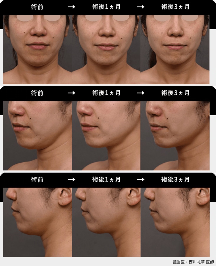 症例写真