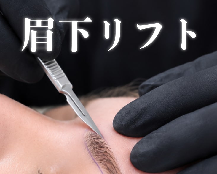 【横浜エリア】新横浜で眉下リフト（眉下切開）をするなら湘南美容クリニック新横浜院