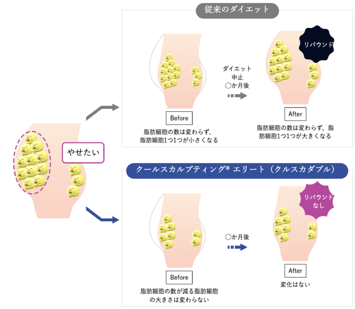 脂肪冷却で脂肪細胞自体の数を減らすから「リバウンド」なし！