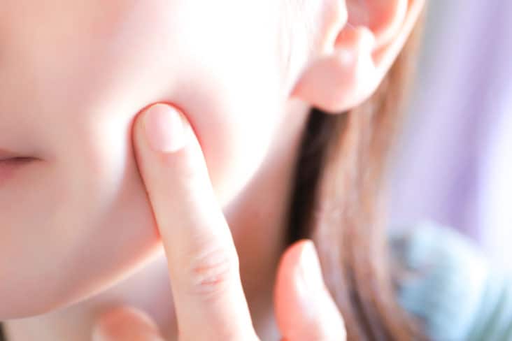 光治療で叶える肌育
