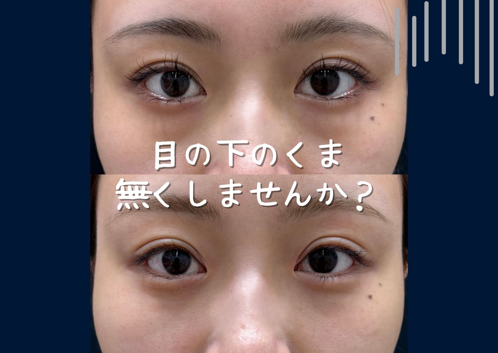そのクマ無くしませんか？👀💦
