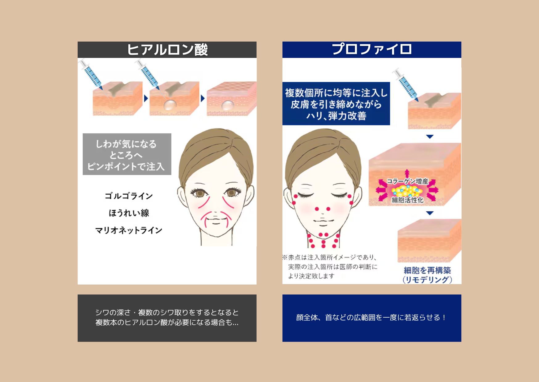 私に最適なのはどっち？