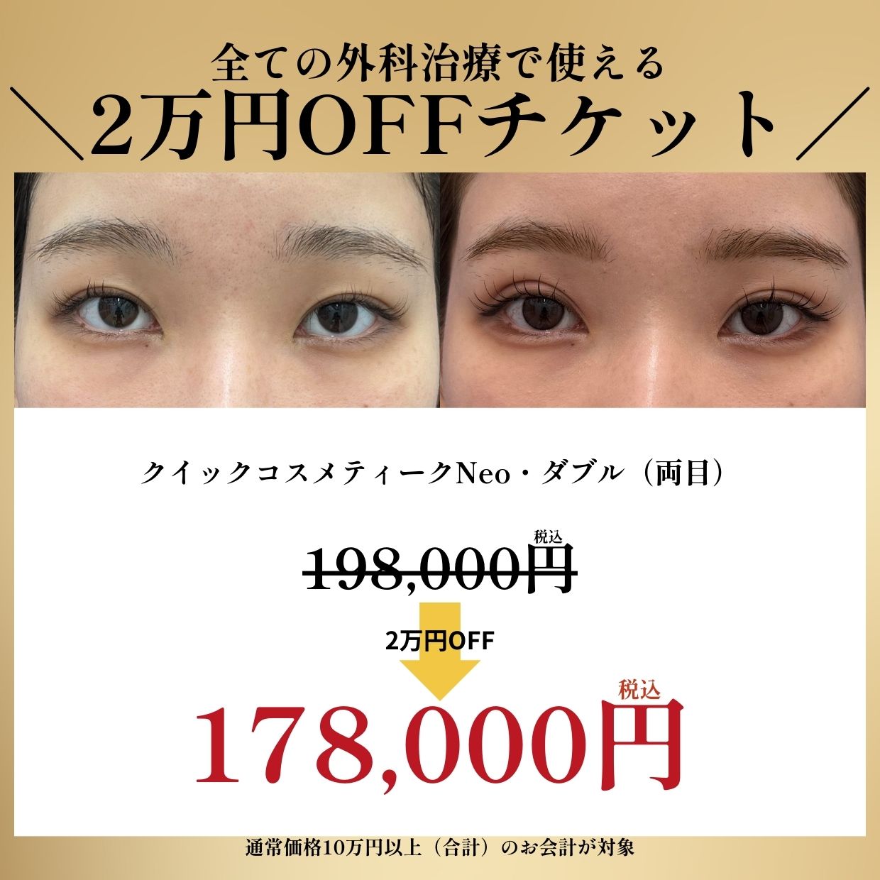 クイックコスメティークNeo・ダブル