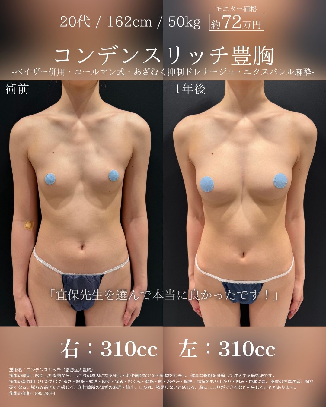 美バスト“症例の美しさ”