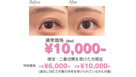 クリニックでのご購入でメリット多数