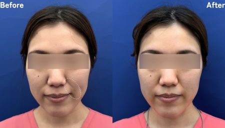 30代を過ぎてから感じ始めた「顔の輪郭の変化」