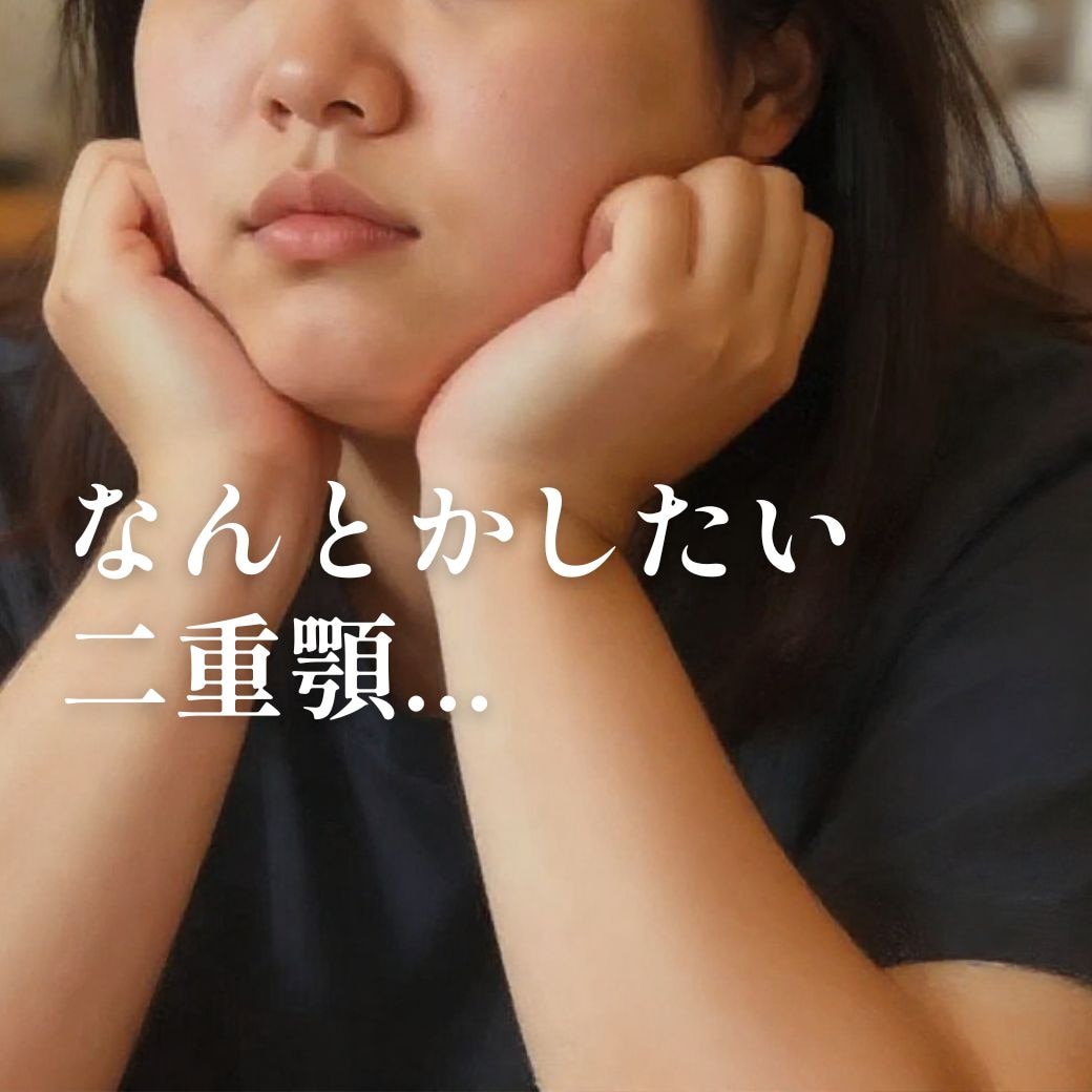 【新治療】顎下すっきリフト！二重顎に悩みの方必見★