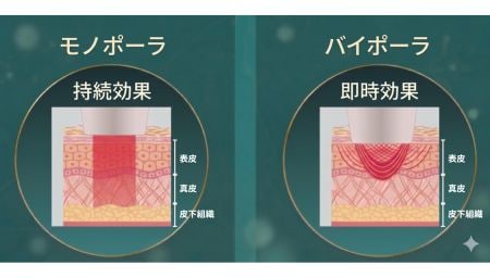 モノポーラ×バイポーラの同時照射で深さの違う層にアプローチ