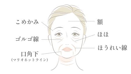 ほうれい線以外にも！ヒアルロン酸注射で人気の部位