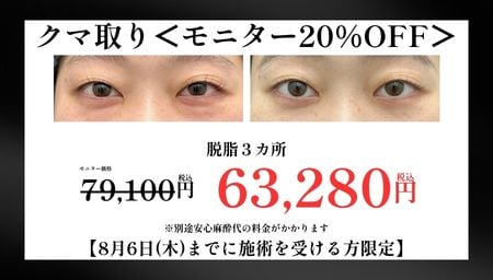 クマ取り(20%OFF)