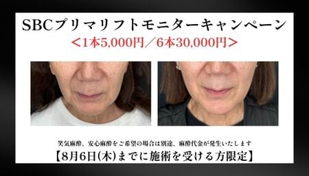 SBCプリマリフト