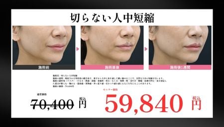 切らない人中短縮