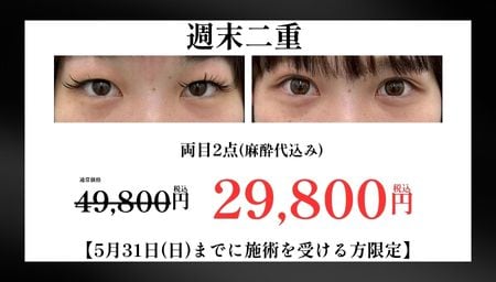埋没二重(週末二重)