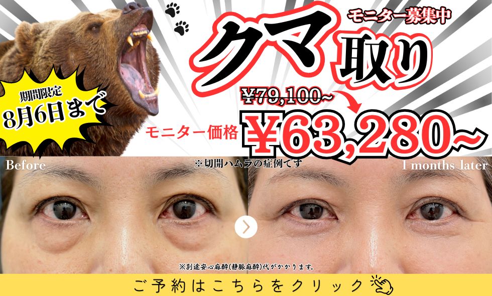 【モニター募集中】形成外科専門医によるクマ・たるみ治療🐻