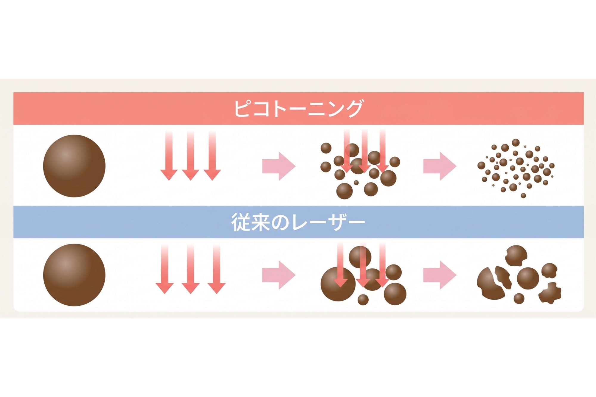ピコ秒レーザーがメラニンを「砕いて」少しずつ排出する仕組み