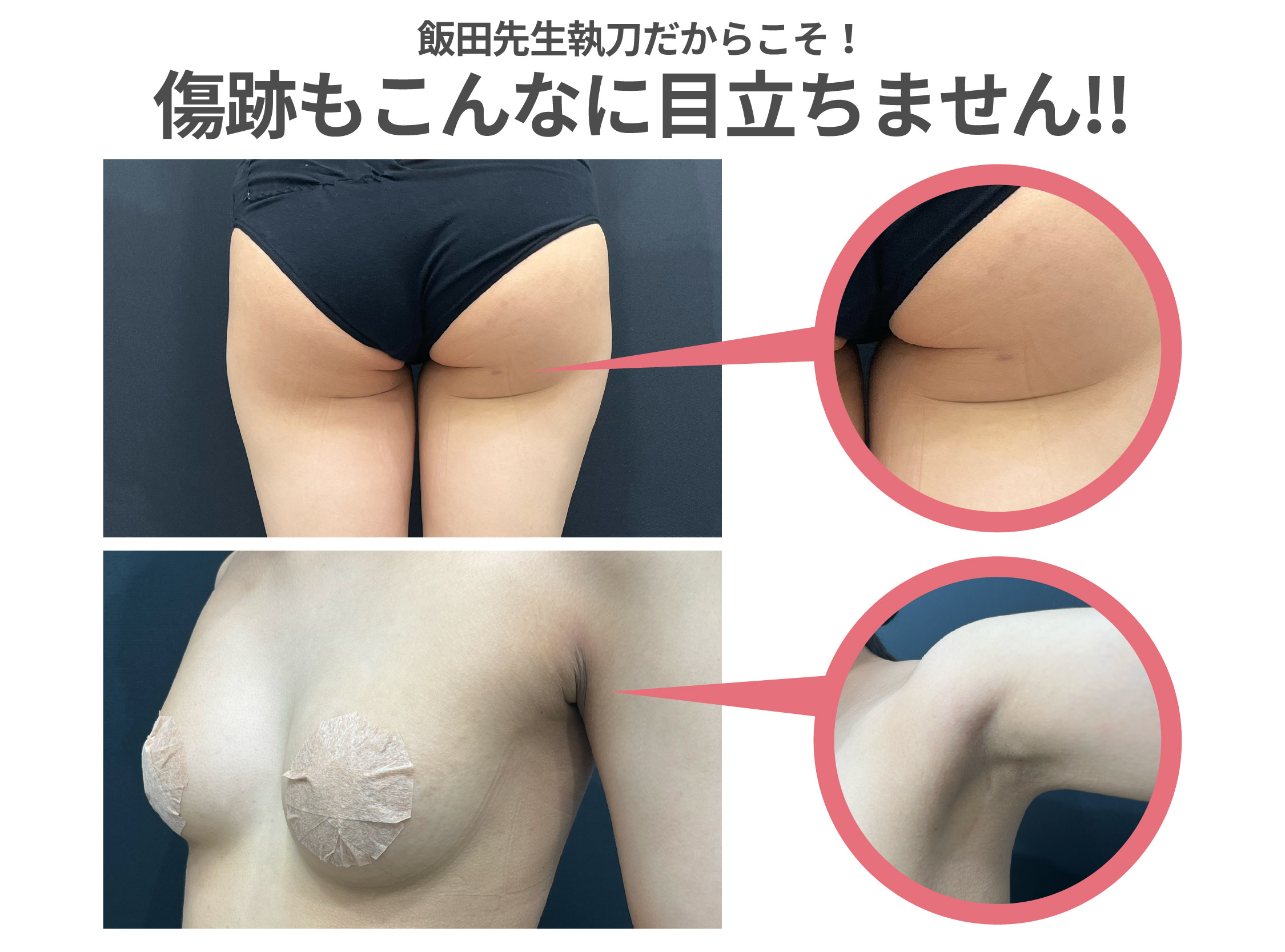 選ばれる理由その2:当たり前に目立たない傷跡