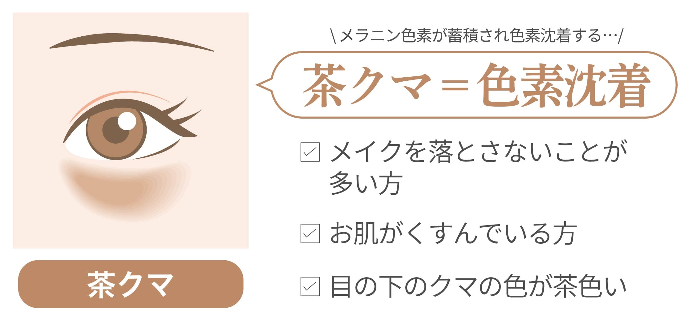 メラニン色素が蓄積されて色素沈着してしまった『茶クマ』