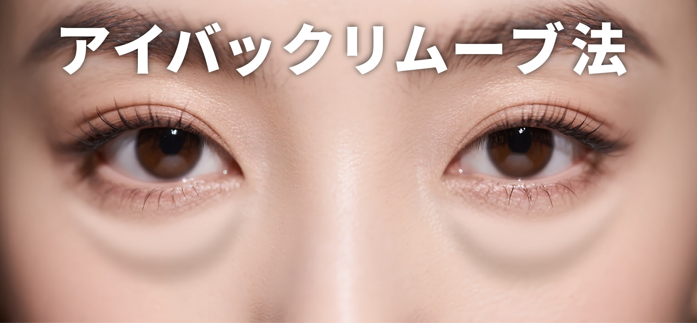 アイバックリムーブ