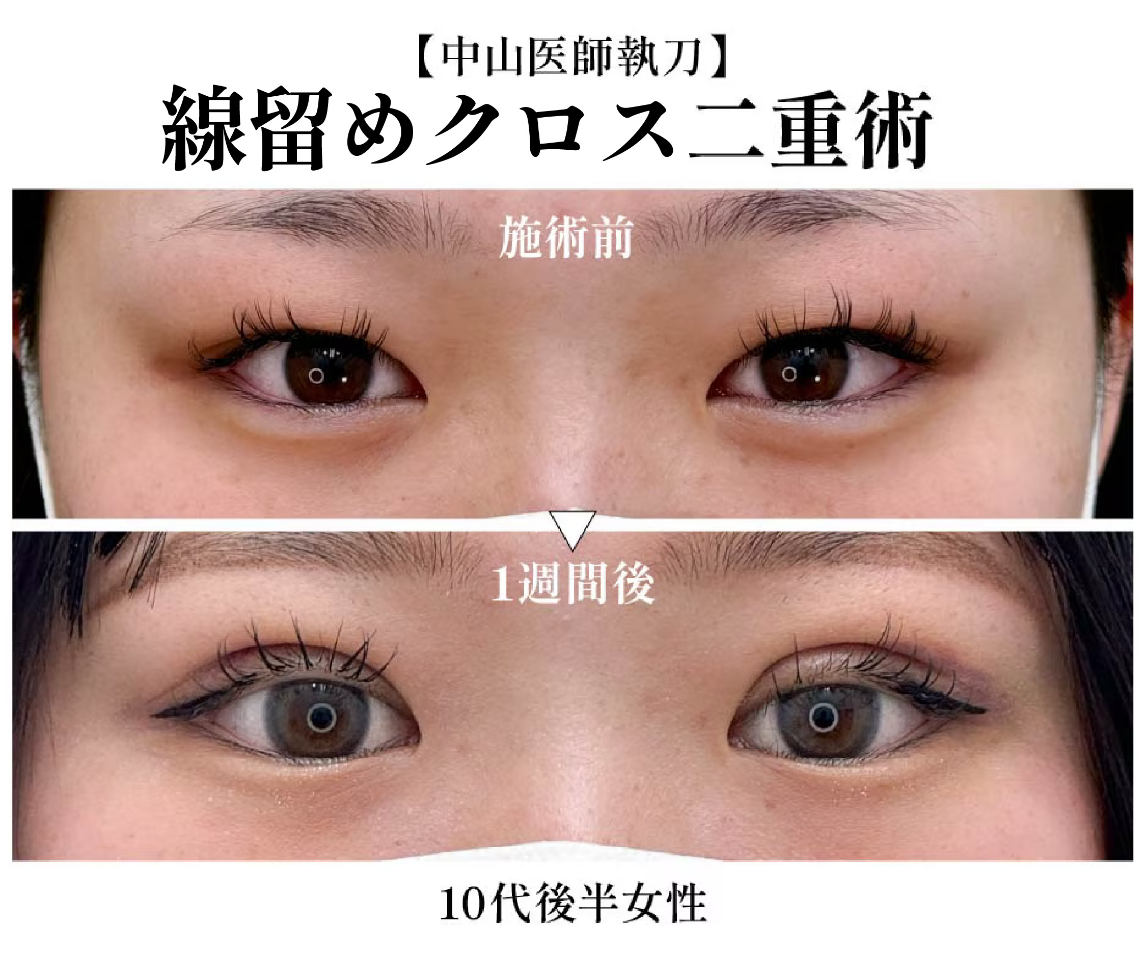 【中山 翔也医師】フォーエバー二重術が大得意✨静岡院在籍医師