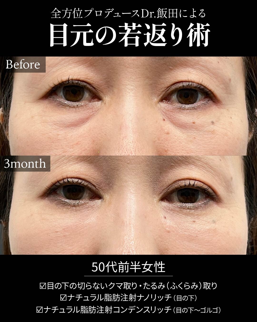 目元の若返り術