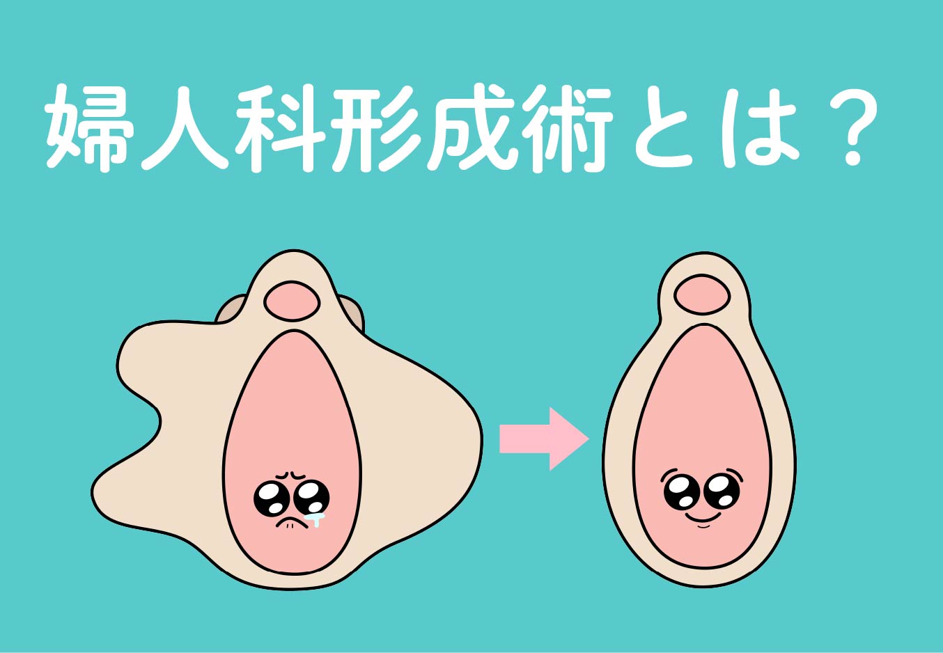 婦人科形成とは?